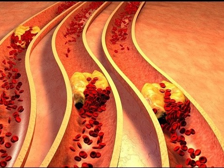 Главный кардиолог Минздрава: «чистки сосудов не существует, это шарлатанство!» Главный кардиолог Минздрава: «чистки сосудов не существует, это шарлатанство!»