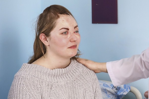 Краснодарские хирурги &laquo;собрали&raquo; лицо 18-летней крымчанки, пострадавшей в ДТП