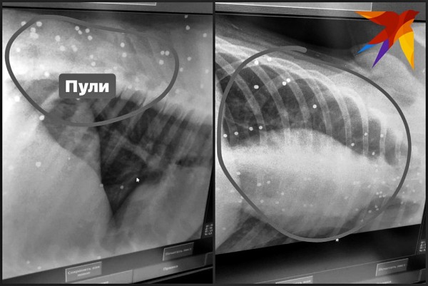 В Краснодаре в бездомного пса всадили больше 100 пуль и оставили умирать В Краснодаре в бездомного пса всадили больше 100 пуль и оставили умирать