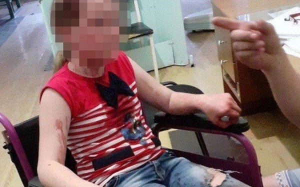 В Сочи школьник выстрелил из пистолета девочке в нос