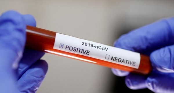 Два сотрудника &laquo;Роскосмоса&raquo; умерли от коронавируса 