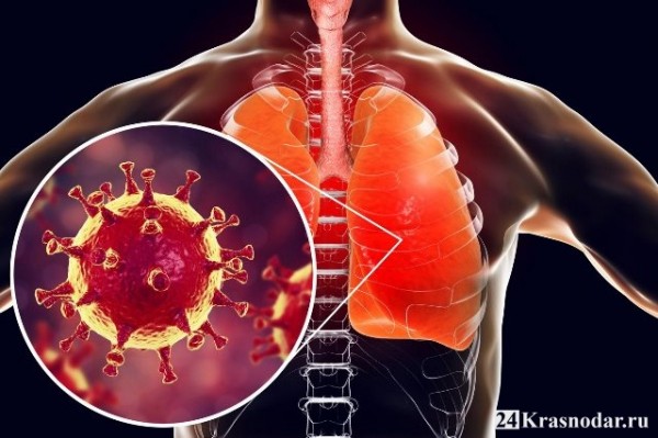 79 новых заболевших коронавирусом