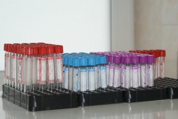 Плюс 92 заболевших коронавирусом за сутки на Кубани Плюс 92 заболевших коронавирусом за сутки на Кубани