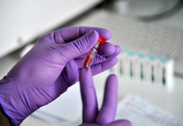 Идем вверх: на Кубани выявлено 99 новых случаев заражения коронавирусом за сутки Идем вверх: на Кубани выявлено 99 новых случаев заражения коронавирусом за сутки