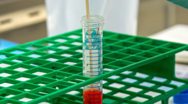 В Тбилисском районе принудительно взяли анализ на коронавирус у мужчины В Тбилисском районе принудительно взяли анализ на коронавирус у мужчины