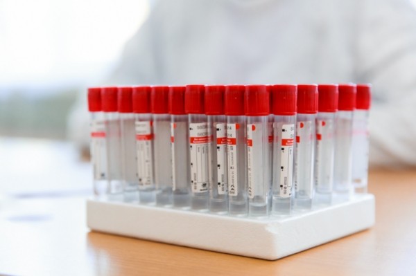 + 71 за сутки: новые данные о заболевших коронавирусом на Кубани