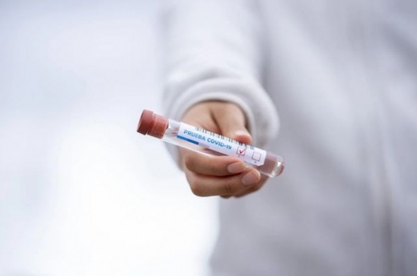 На Кубани за время пандемии от коронавируса погибли 113 человек На Кубани за время пандемии от коронавируса погибли 113 человек