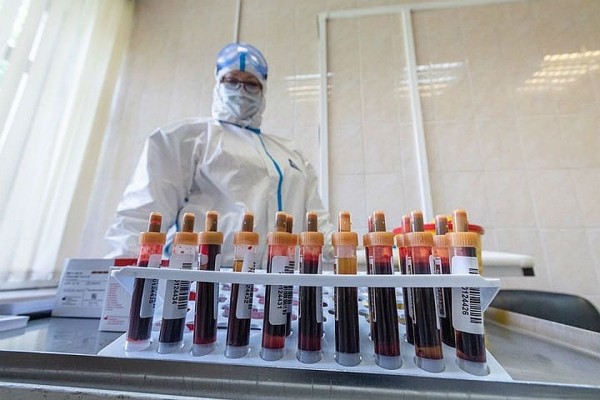 Коронавирус в Краснодарском крае, последние новости на 10 июля: установлен рекорд по числу выздоровевших Коронавирус в Краснодарском крае, последние новости на 10 июля: установлен рекорд по числу выздоровевших