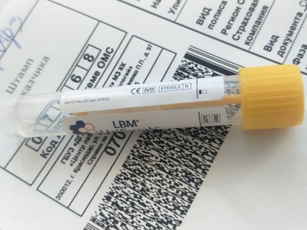 В Краснодарском крае выявлены 87 новых случаев заболевания COVID-19 В Краснодарском крае выявлены 87 новых случаев заболевания COVID-19