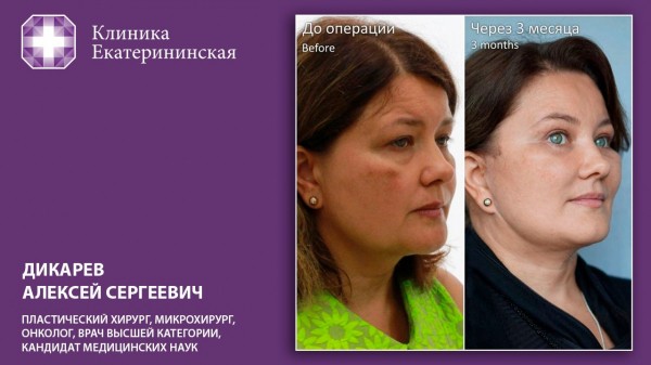 Не надо стесняться. Пластические операции, которые меняют жизнь Не надо стесняться. Пластические операции, которые меняют жизнь