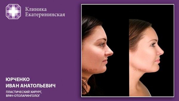 Не надо стесняться. Пластические операции, которые меняют жизнь Не надо стесняться. Пластические операции, которые меняют жизнь