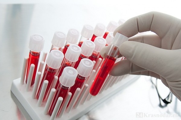 В Краснодарском крае зафиксировано 18 900 случаев заболевания ВИЧ-инфекцией В Краснодарском крае зафиксировано 18 900 случаев заболевания ВИЧ-инфекцией