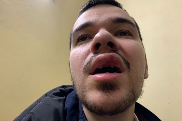 В МВД прокомментировали информацию об избиении краснодарского журналиста