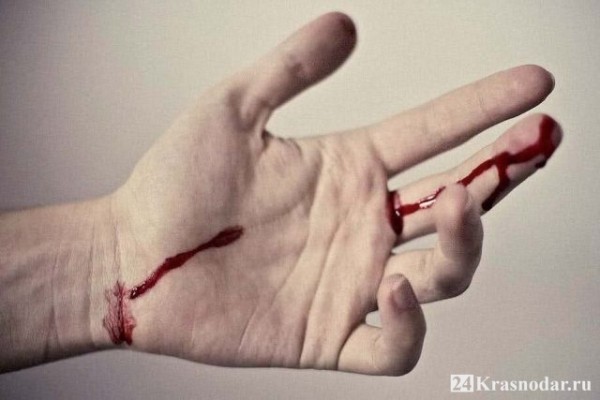 Умирая, просил прохожих о помощи